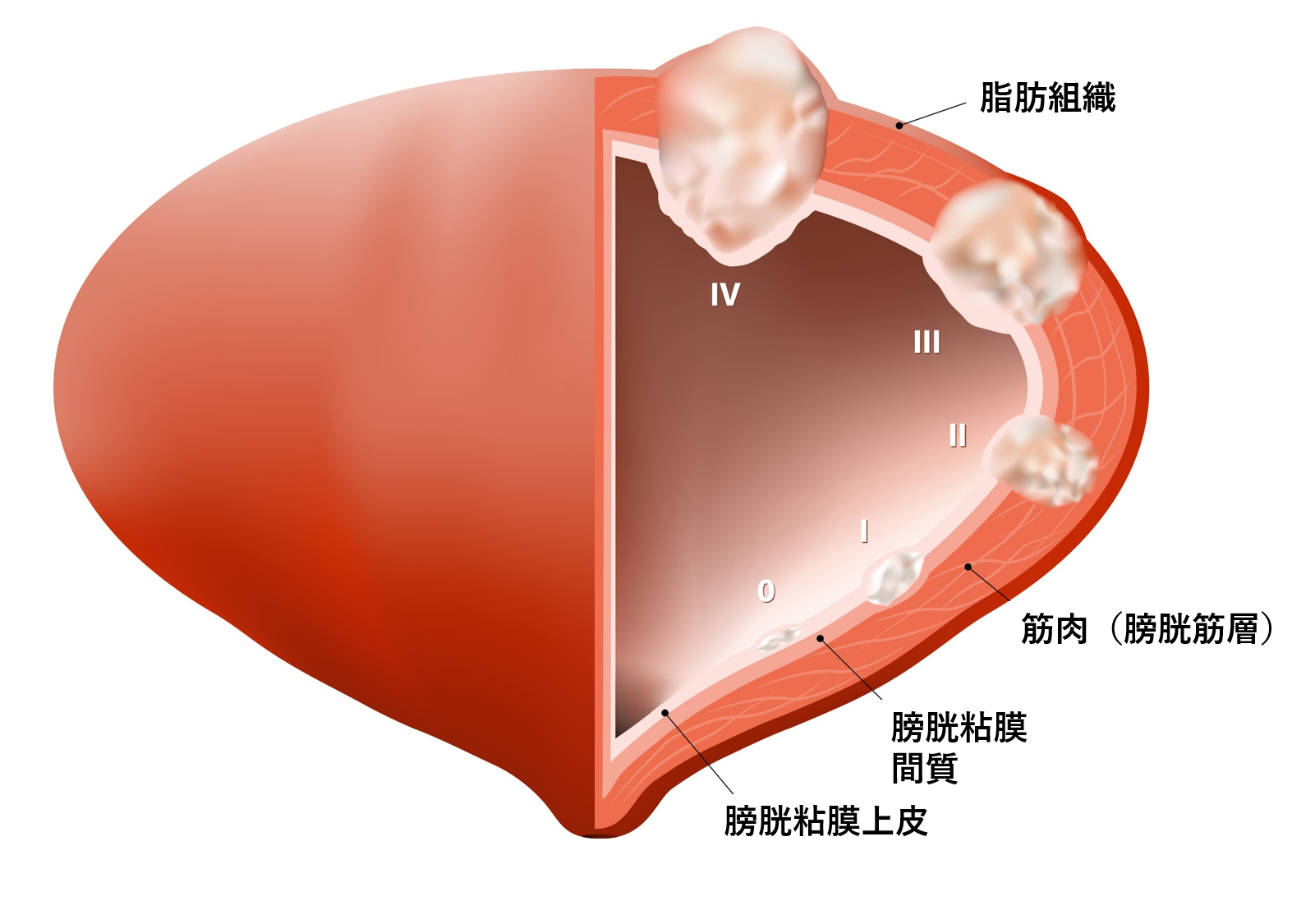 一、膀胱的形态和膀胱壁的构造-基础医学-医学