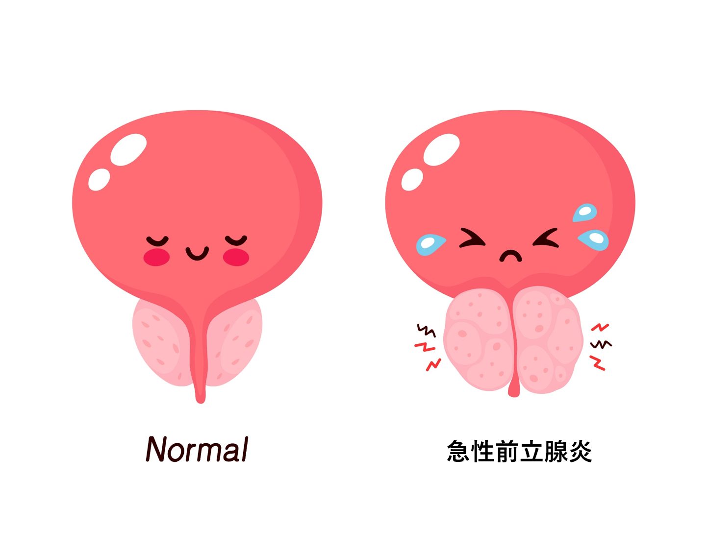 犬の前立腺炎
